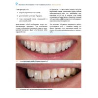 Анатомия передних зубов и изучение принципов естественной улыбки (Фото 5)