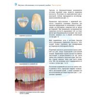 Анатомия передних зубов и изучение принципов естественной улыбки (Фото 6)
