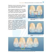 Анатомия передних зубов и изучение принципов естественной улыбки (Фото 7)