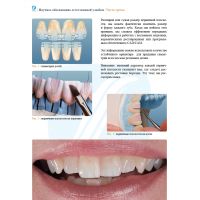 Анатомия передних зубов и изучение принципов естественной улыбки (Фото 8)