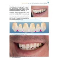 Анатомия передних зубов и изучение принципов естественной улыбки (Фото 9)