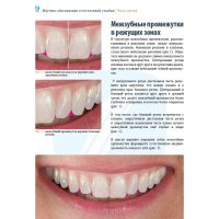 Анатомия передних зубов и изучение принципов естественной улыбки (Фото 10)