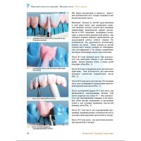 Нанесение керамики. Передние и боковые зубные протезы (Фото 1)