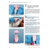 Нанесение керамики. Передние и боковые зубные протезы (Фото 7)